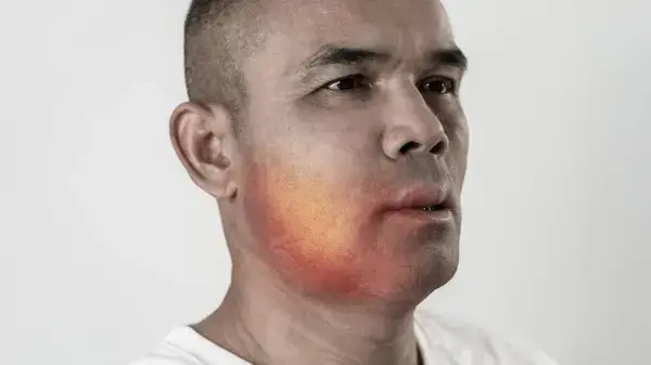 réaction allergique cutanée