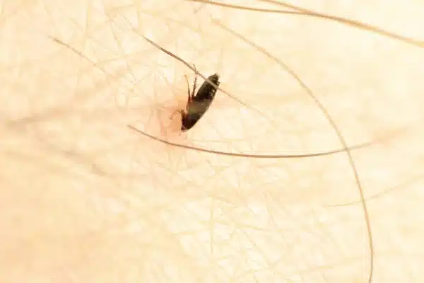 puce sur la peau humaine avec des poils